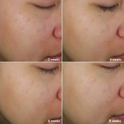 Novage+ Bright Intense -ihonhoitosetti2.webp